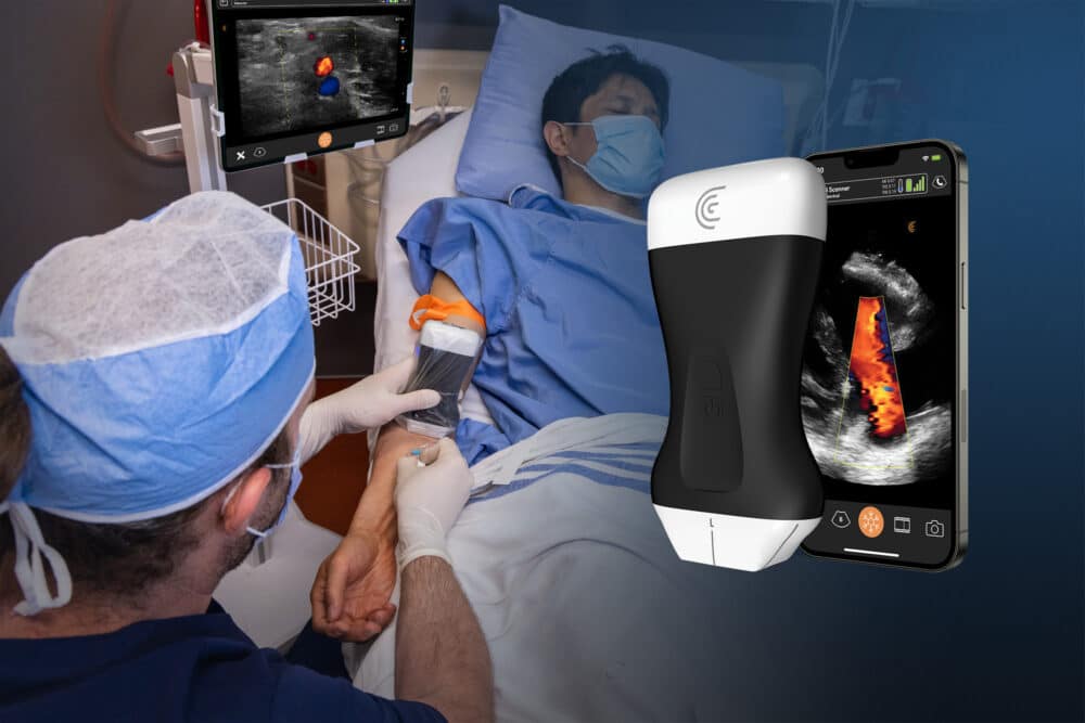 Q&A: Clarius on Its PAL HD3 Wireless Dual-Array AI-assisted Ultrasound