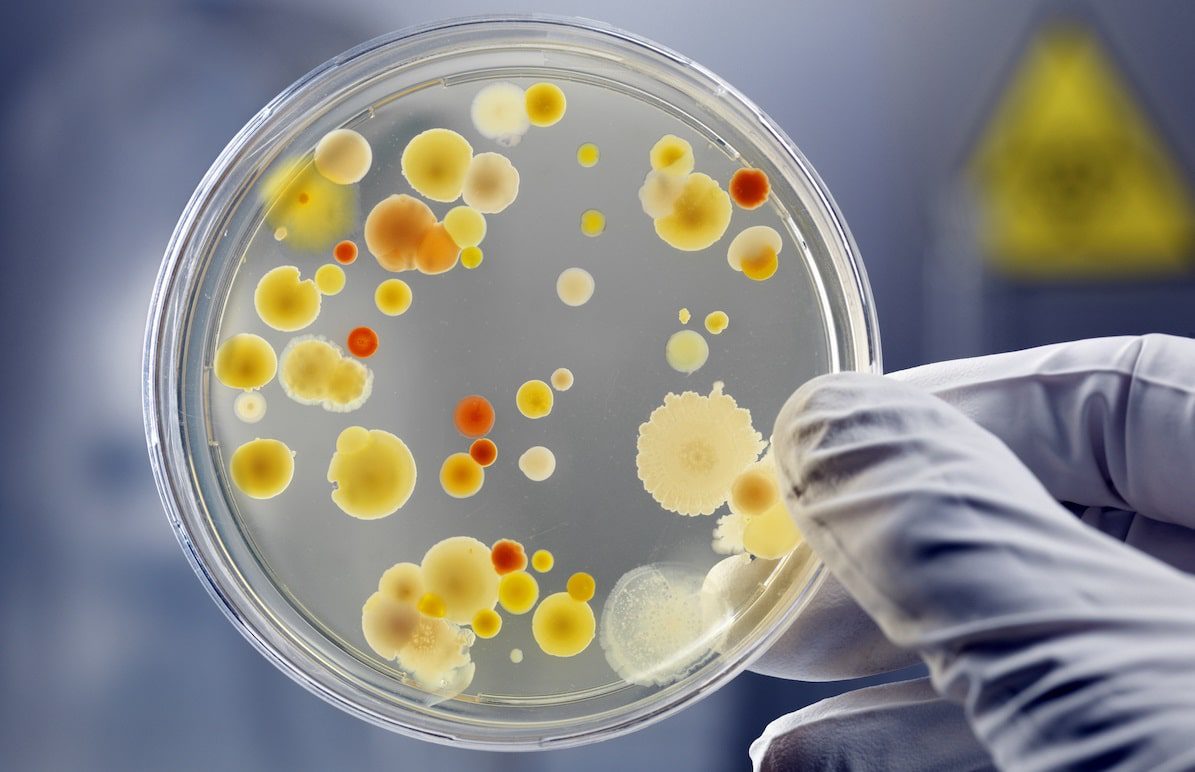 Under the microscope: the rise of antimicrobial resistance. (Credit: Photo: Getty Images/Andreas Reh)