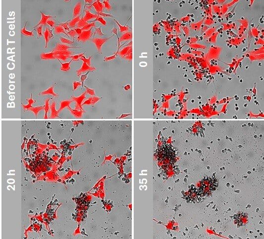 cart-cells-kill-tumor-cells
