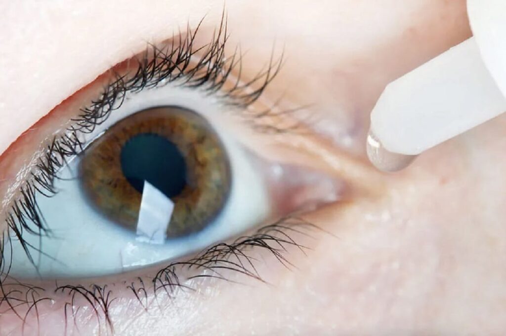 Breakthrough Eye Implant Marks a New Era in Glaucoma Surgery 