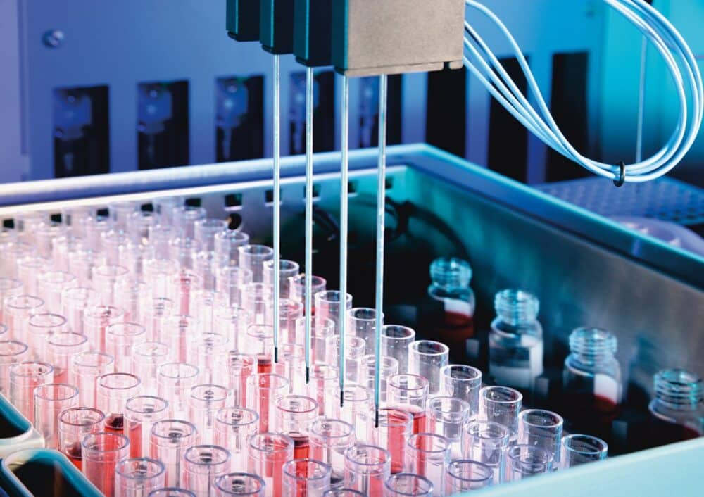 Automation in Medical Laboratory Diagnostics: Smooth Sailing Through the Laboratory