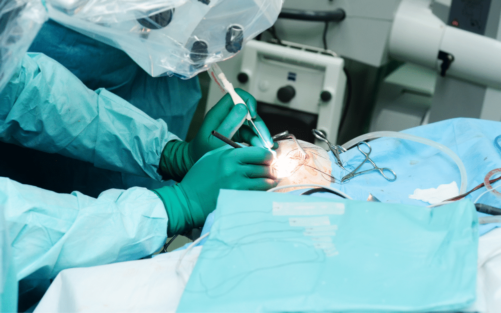 The Future of Brain Surgery: Micro 3D Printing Unlocks New Possibilities for Cavernoma Treatment