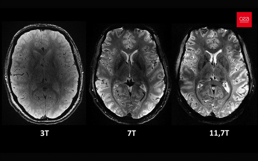 [Summer Rewind] Iseult, The World’s Most Powerful MRI