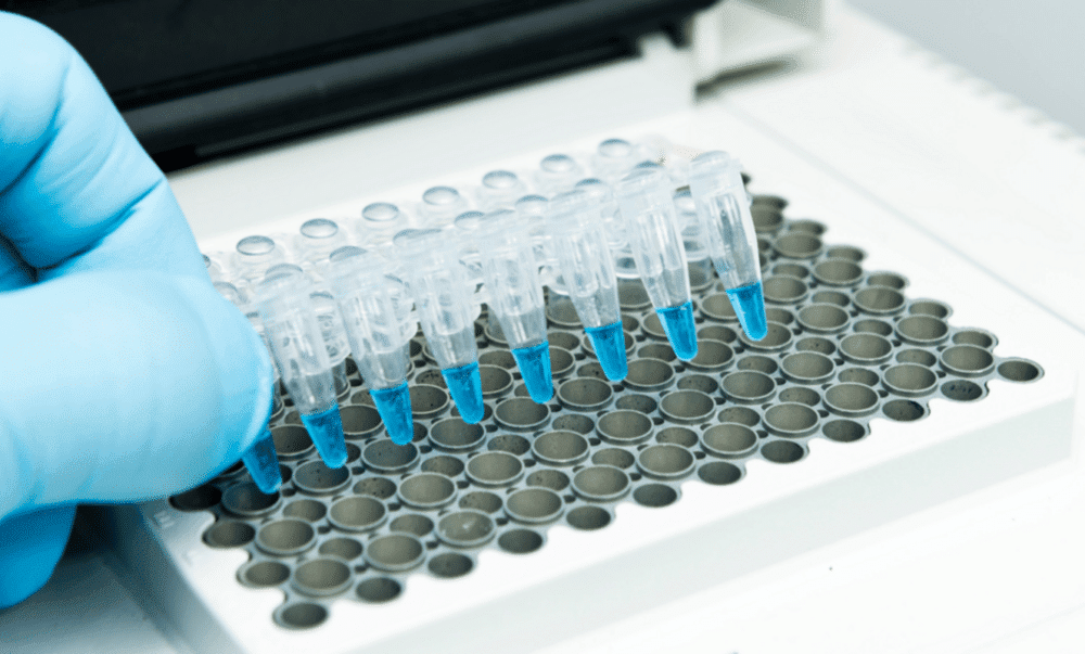 myEDIT-B is the first blood test aimed at assisting in the diagnosis of mental health conditions by distinguishing between bipolar disorders and depression in adults. (Credit: SYNLAB)