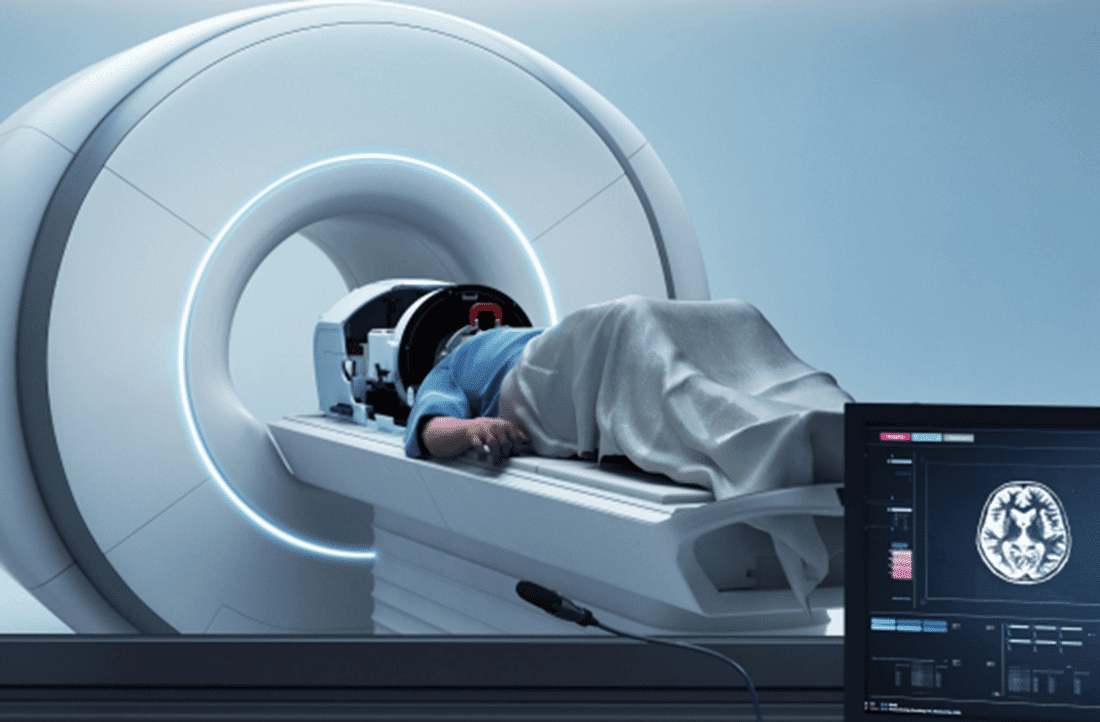 Ultrafocused-MRI image (Credit: Insightec)