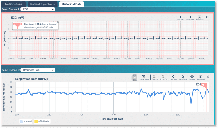 Courtesy of Vital Connect