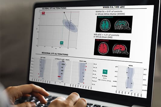 BrainQuant. Courtesy of BrainTale.