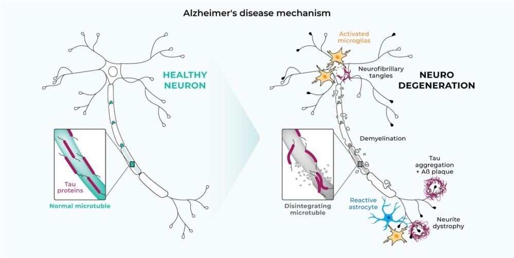 Courtesy of BrainTale