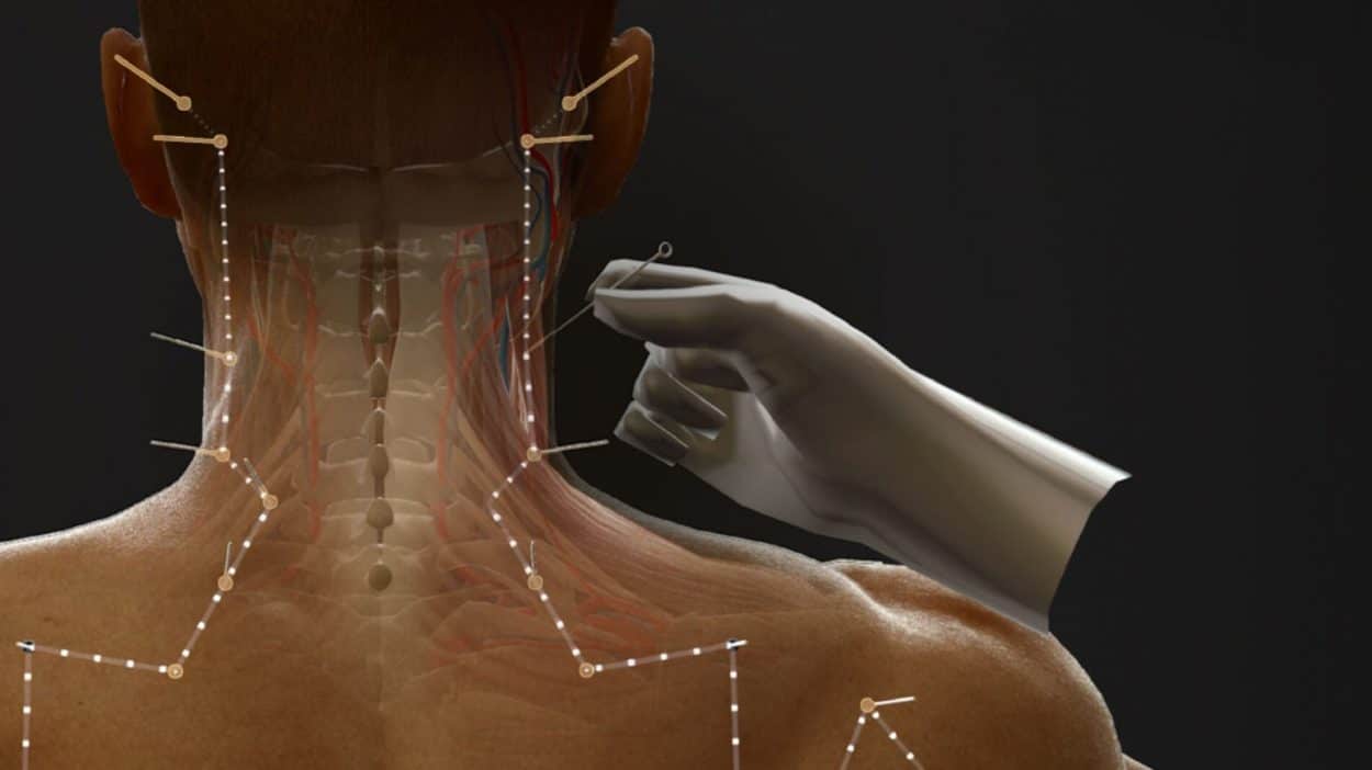 Traditional Chinese Medicine Is Pushing Digital Boundaries