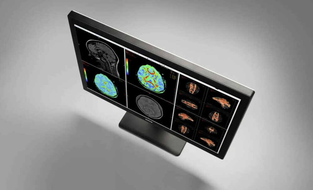 barco-technology-2-1000x608-1 remote radiology with Barco equipment