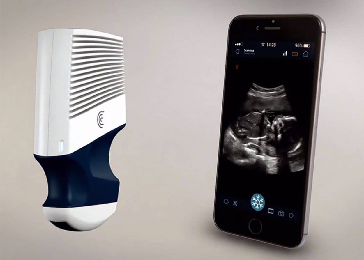 Meet Clarius, Pocket-Sized Wireless Scanner