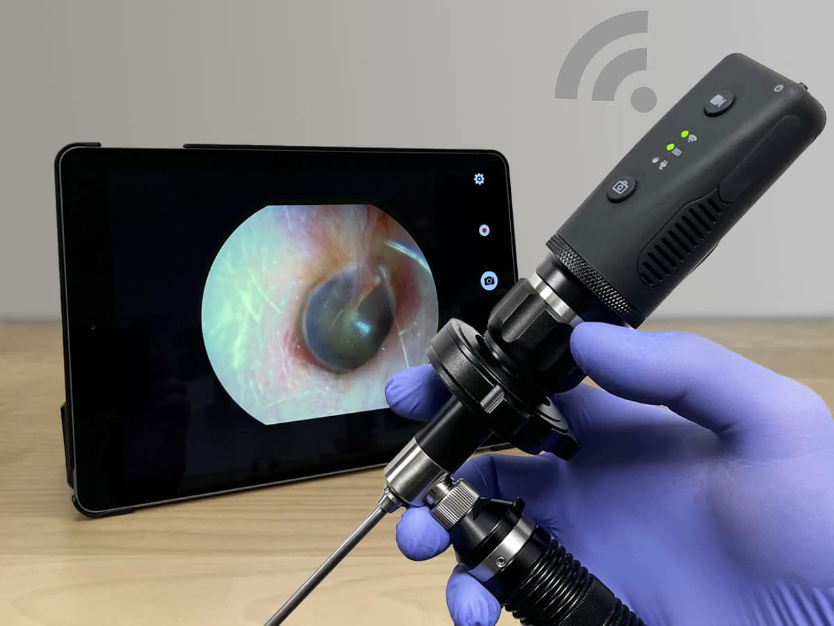 de1270-main-with-backgroundno-logo The DE1270 Mobile Wireless Endoscopy Camera. (Credit: Firefly)