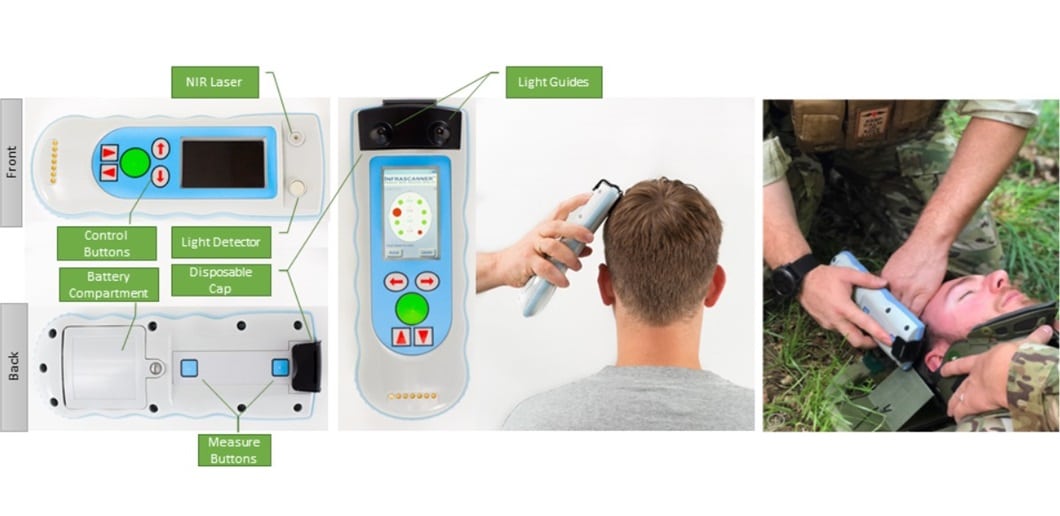 infrascan_model2000 The Infrascanner Model 2000 has been ruggedized for use in remote locations and on the battlefield. (Credit: InfraScan)