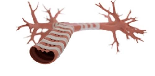 (Credit: Lazarro Medical)