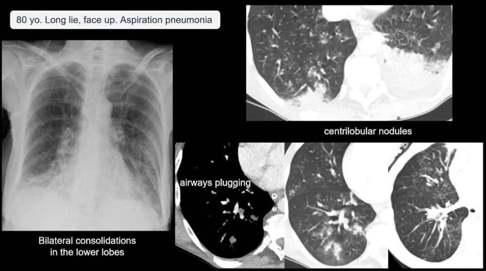 Screenshot of presentation. Courtesy of the panelist and ECR.