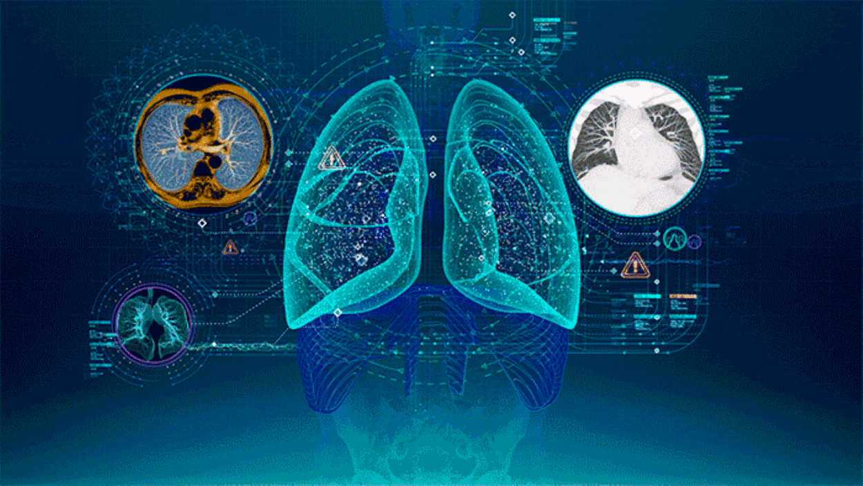 Advances and Challenges in Medical Imaging