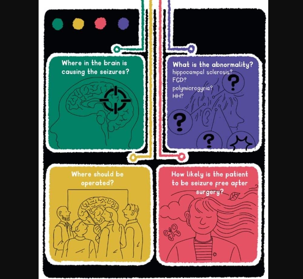 meld-project2-1000x920-1 MELD Focal Epilepsies: Project to automatically detect a broad range of causes of focal epilepsy. (Credit: MELD Project)