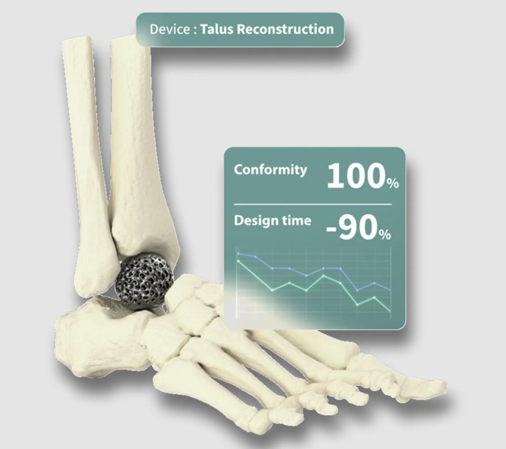 Advanced biomaterials: OsseoLabs leverages cutting-edge 3D-printing to create tailor-made implants and medical devices with unrivaled accuracy.
