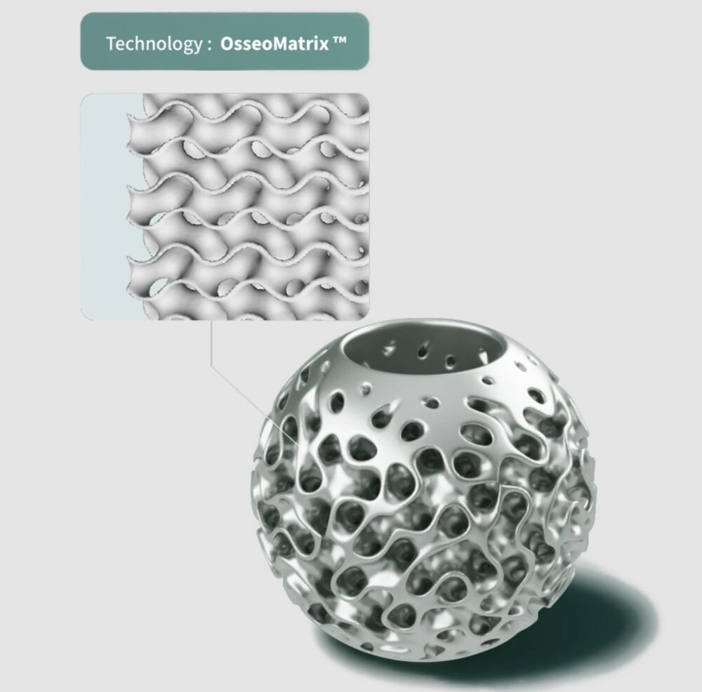 OsseoMatrix™ is OsseoLab's patented porous architecture, meticulously crafted to mirror natural bone while accommodating each patient’s anatomy.
