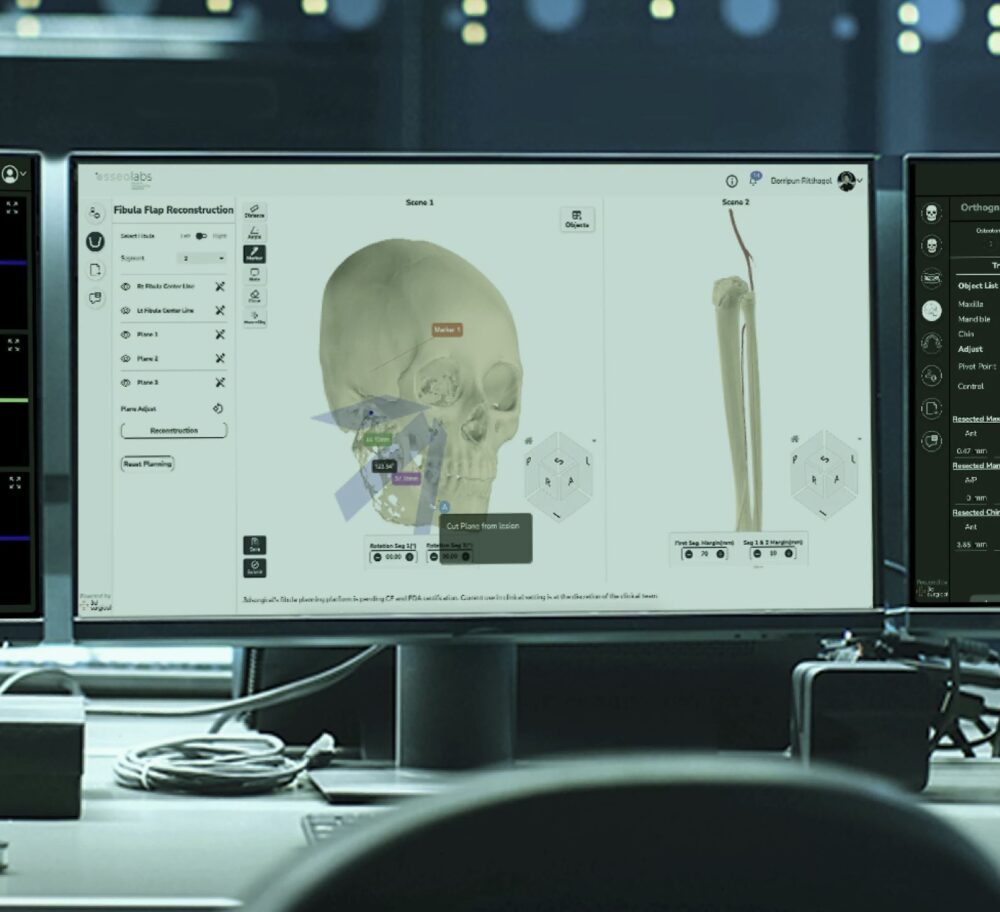 Courtesy of OsseoLabs