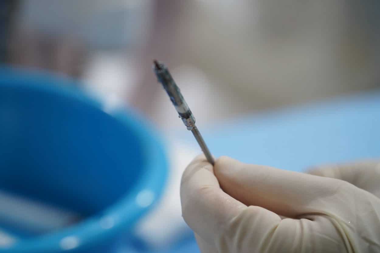 Minimally-Invasive Cardiac Implant Helps the Heart Help Itself