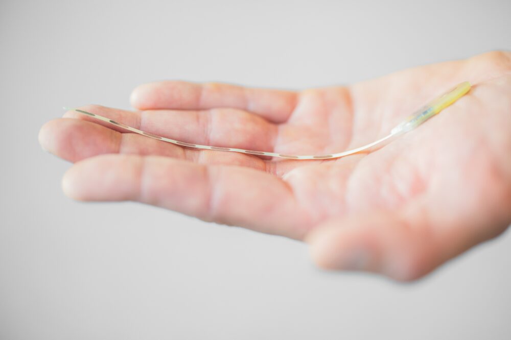 Beyond the Pain: A New Era in Migraine Treatment