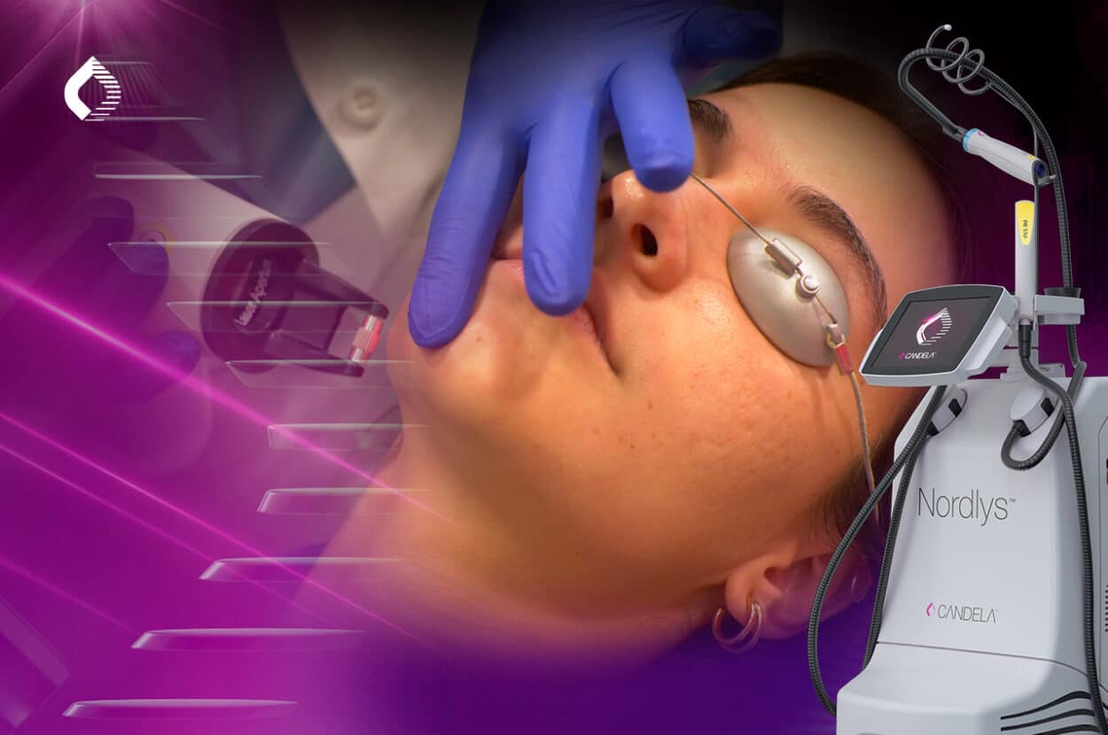 SPONSORED. Safe and Effective Non-Ablative Laser Treatment of Scars