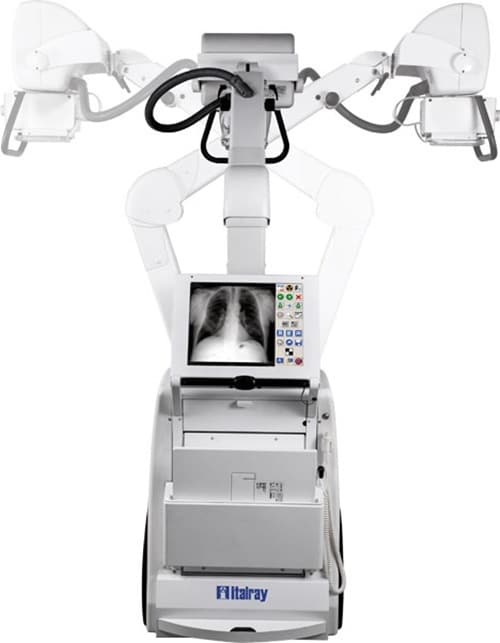 xfm-tre-bracci XFM, a mobile digital X-ray system. (Credit: Italray)